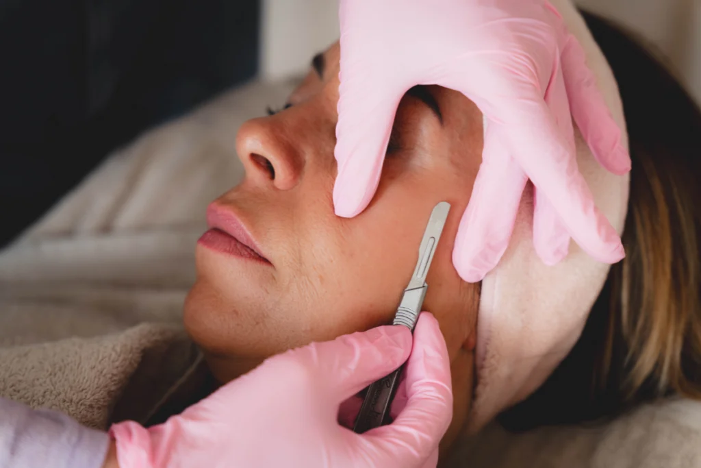 Dermaplaning