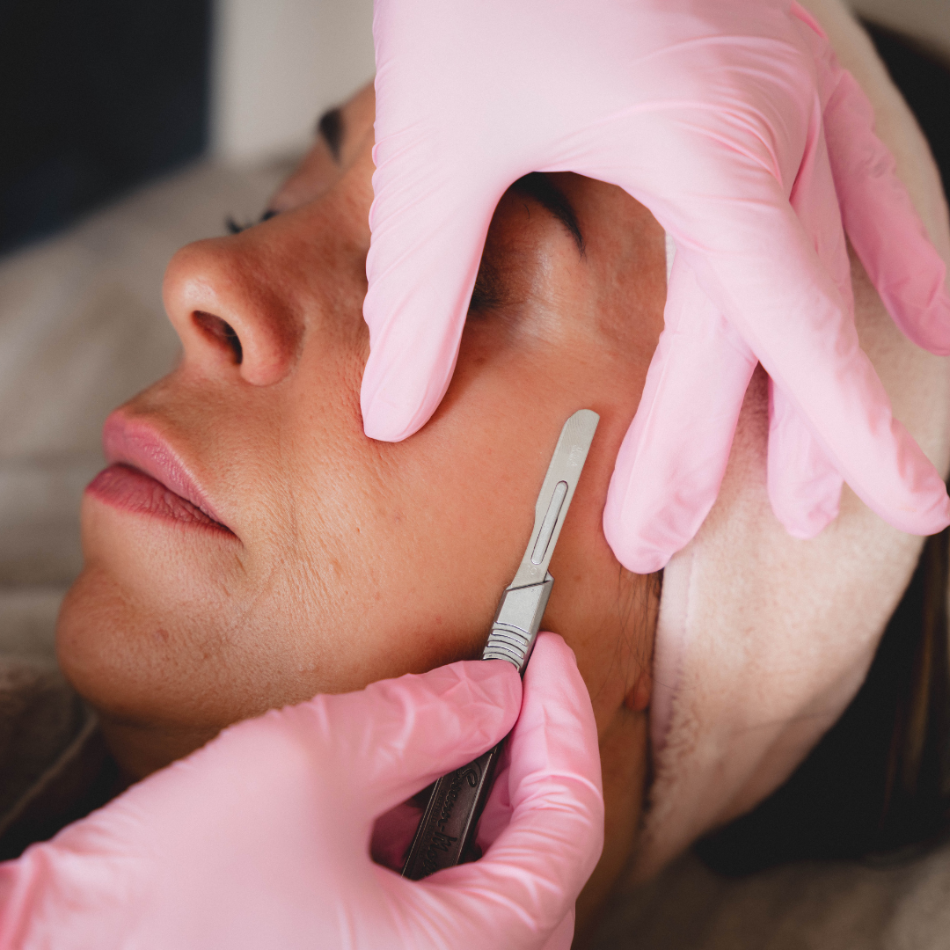 Dermaplaning