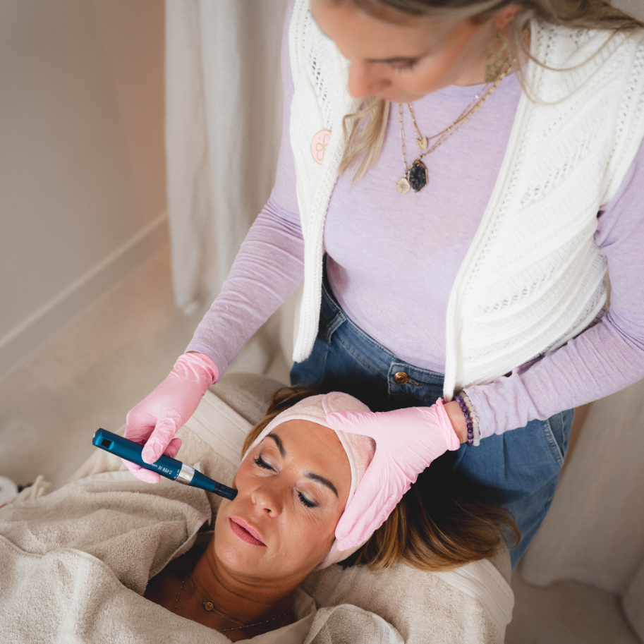 Microneedling